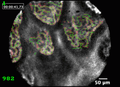 Biomedical Image Analysis