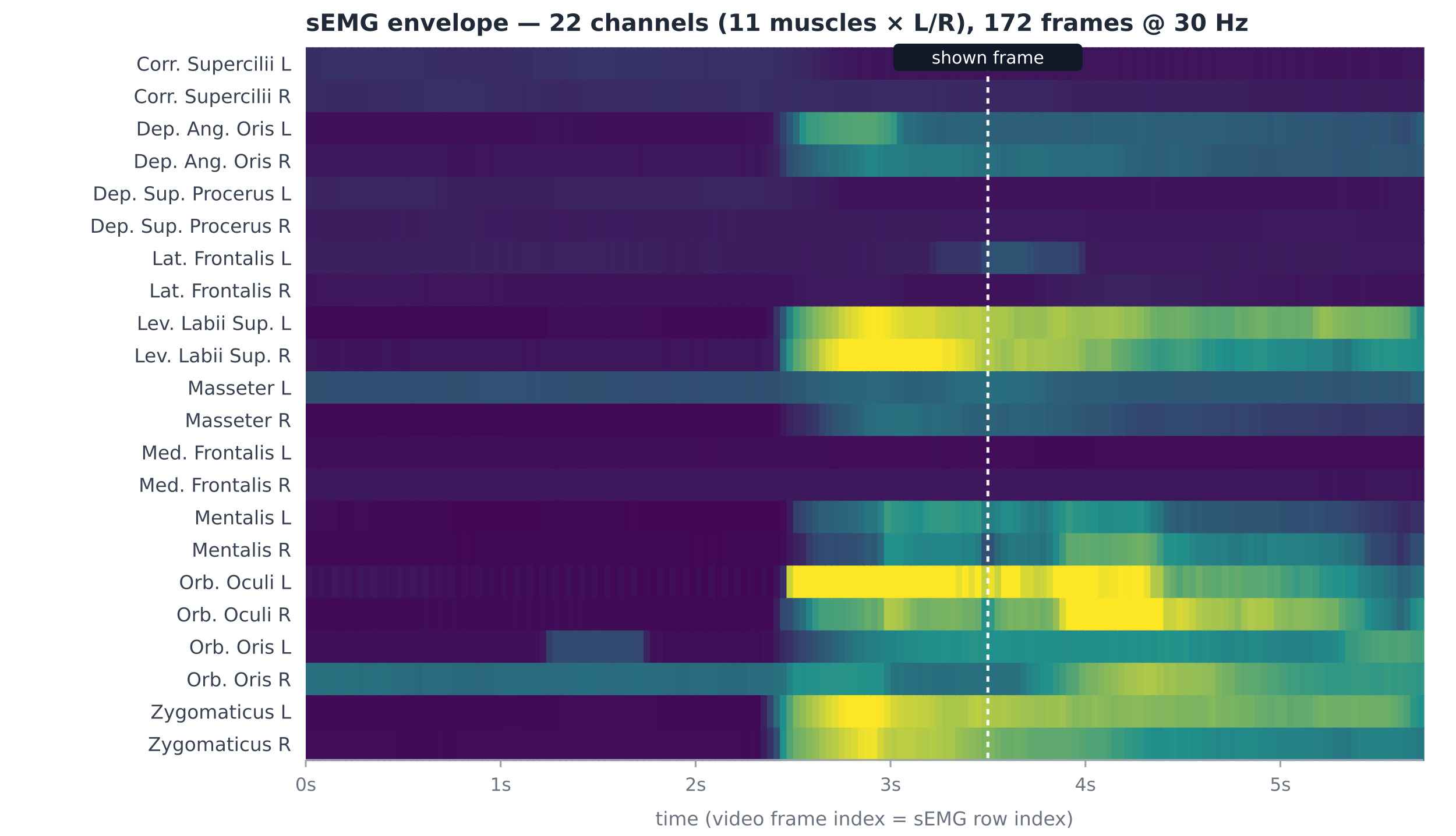 22-channel sEMG heatmap